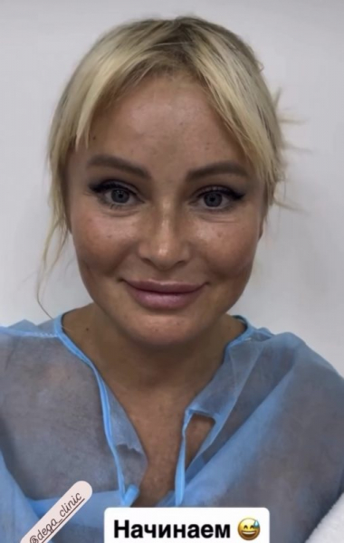 «Похожа на маму Стифлера»: Дана Борисова сделала пластику лица: первые кадры после операции 
