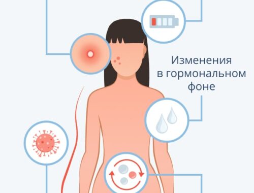 Что такое детоксикация при зависимости