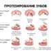 Современные методы протезирования зубов