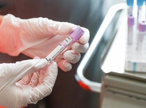 Каждый четвертый россиянин ни разу не проверялся на рак Каждый четвертый россиянин ни разу не проверялся на рак