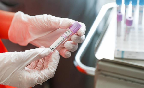 Каждый четвертый россиянин ни разу не проверялся на рак