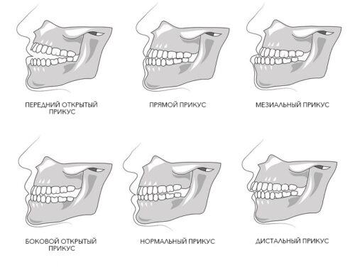 Кто такой ортодонт и чем он занимается