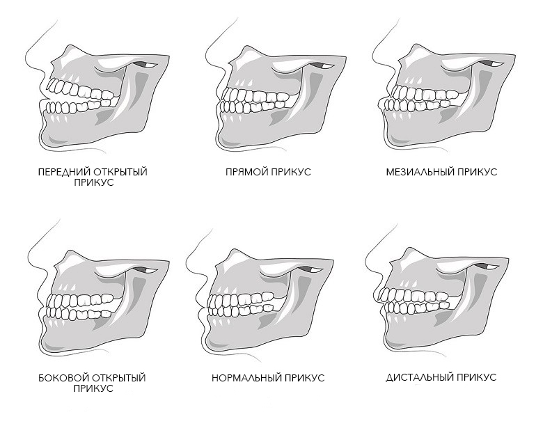 Кто такой ортодонт и чем он занимается