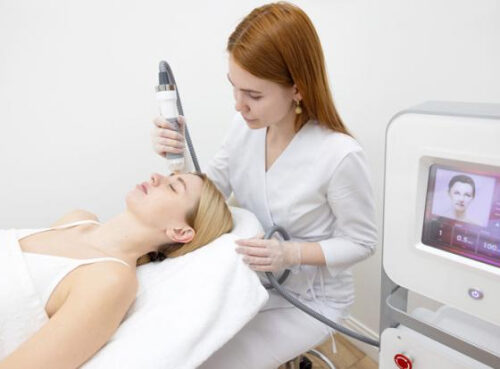 Микроигольчатый RF-лифтинг Vivace — что это за процедура?