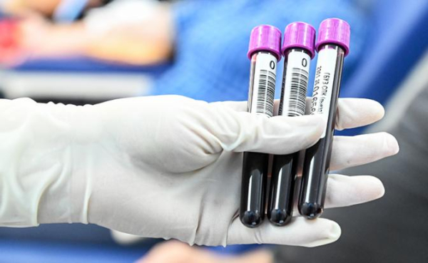 Озвучен самый простой способ выявить болезнь Альцгеймера