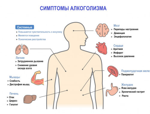 Причины и опасности продолжительного запоя