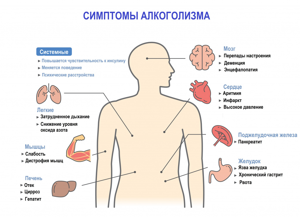 Причины и опасности продолжительного запоя