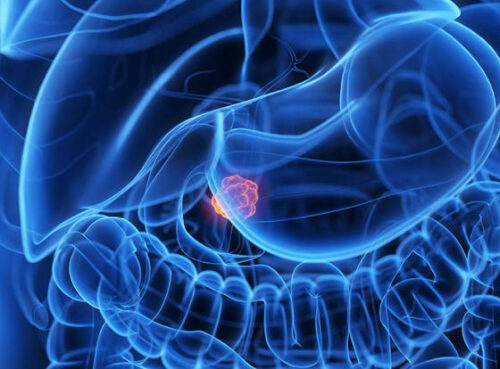 Врач назвал три сигнала разрушения поджелудочной Врач назвал три сигнала разрушения поджелудочной