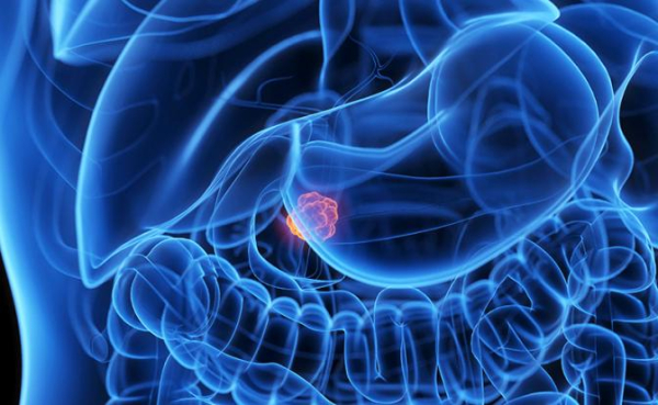 Врач назвал три сигнала разрушения поджелудочной