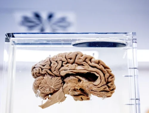 Обнаружена область мозга, связанная с хронической болью. Это дает надежду на новые методы лечения Обнаружена область мозга, связанная с хронической болью. Это дает надежду на новые методы лечения