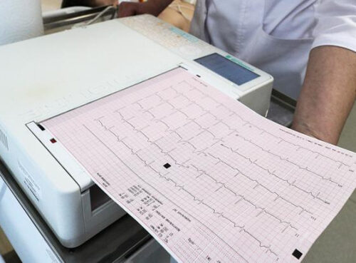 Инфаркт через три дня: Названы самые первые опасные сигналы Инфаркт через три дня: Названы самые первые опасные сигналы