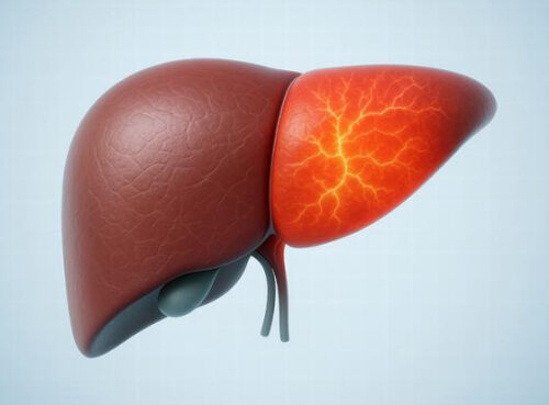 Жирная печень — редкие волосы: ученые обнаружили неожиданную связь