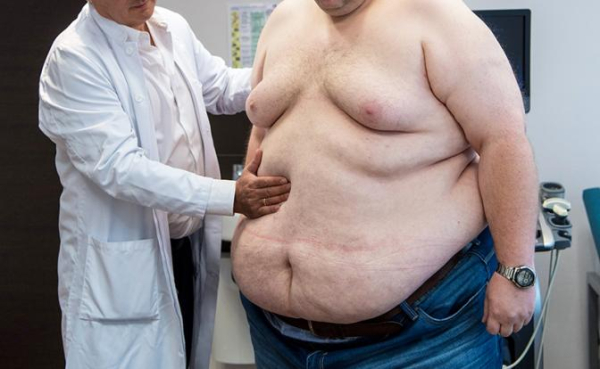 Слишком жирно — терять триллионы рублей из-за не в меру упитанных сограждан