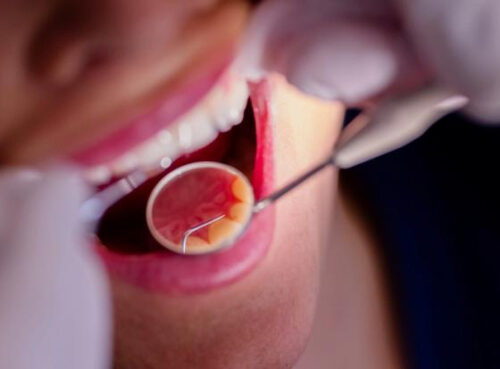 Ученые придумали, как заставить бормашину перестать пугать пациентов Ученые придумали, как заставить бормашину перестать пугать пациентов