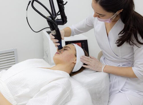 Лазерная шлифовка рубцов при постакне