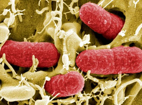 Профессор назвала самые опасные бактерии, не поддающиеся антибиотикам