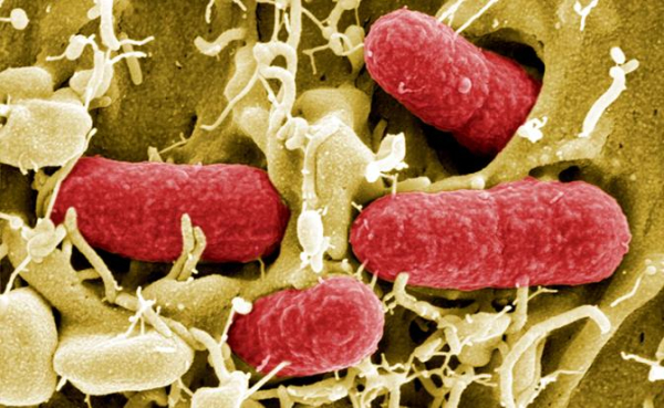 Профессор назвала самые опасные бактерии, не поддающиеся антибиотикам