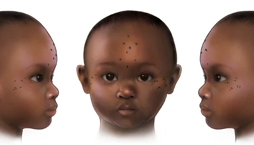 PNAS: 1400 лет назад нубийцы начали делать младенцам татуировки на лице PNAS: 1400 лет назад нубийцы начали делать младенцам татуировки на лице