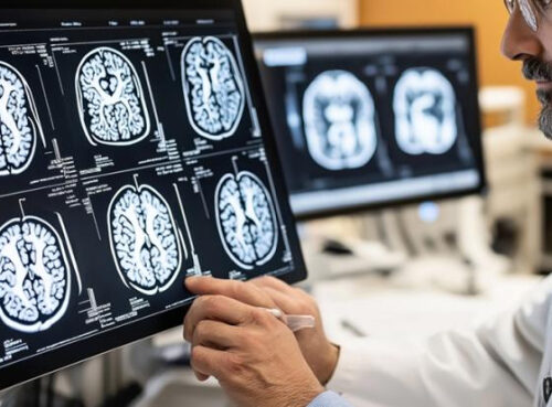 Врач раскрыл скрытые признаки опухоли мозга, на которые редко обращают внимание Врач раскрыл скрытые признаки опухоли мозга, на которые редко обращают внимание